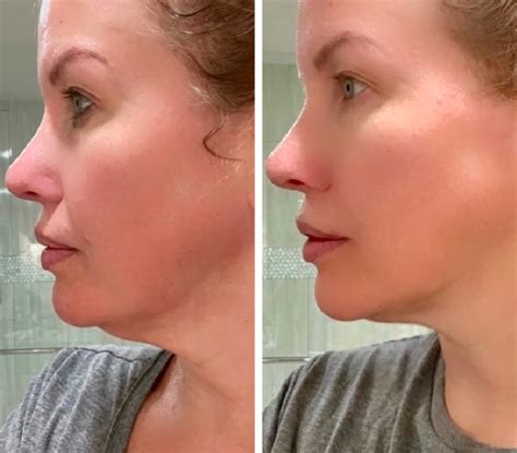 jade roller before and after|Gua Sha before/after: results and photos .